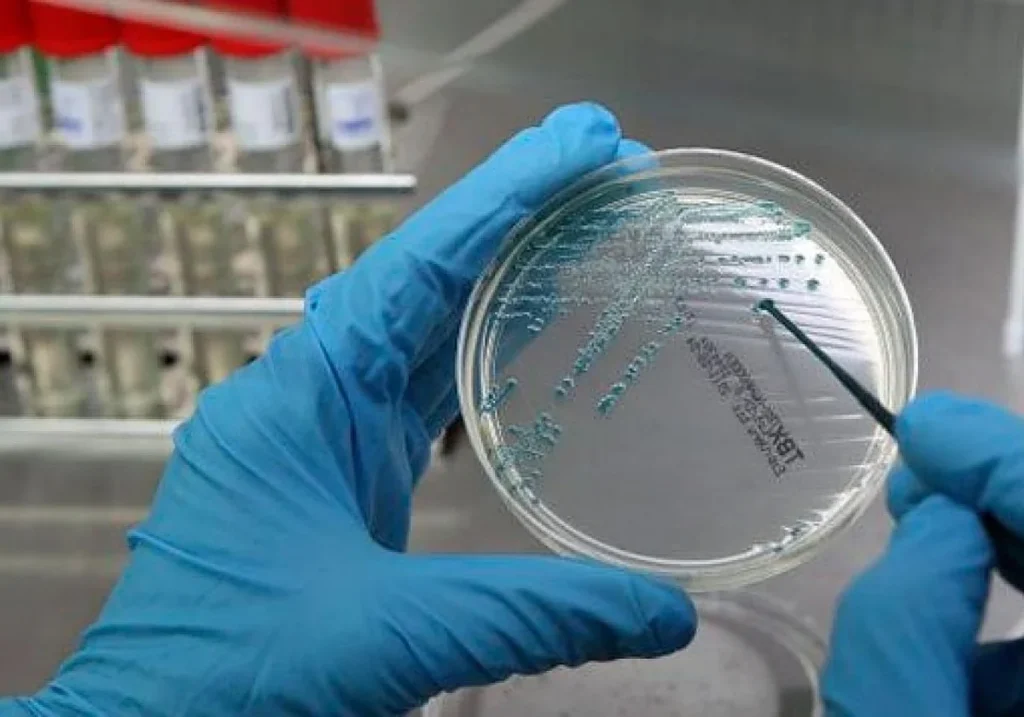 Un análisis de ADN Efe / LA VERDAD